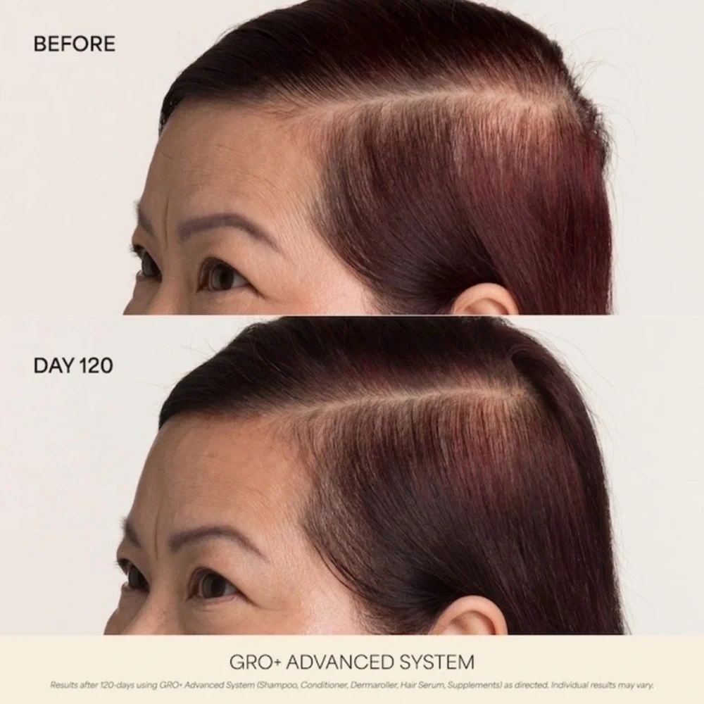 🎸Vegamour🎸🔥NWT🔥GRO+ Advanced Hair Serum for Severe Signs of Thinning-1 Fl oz.